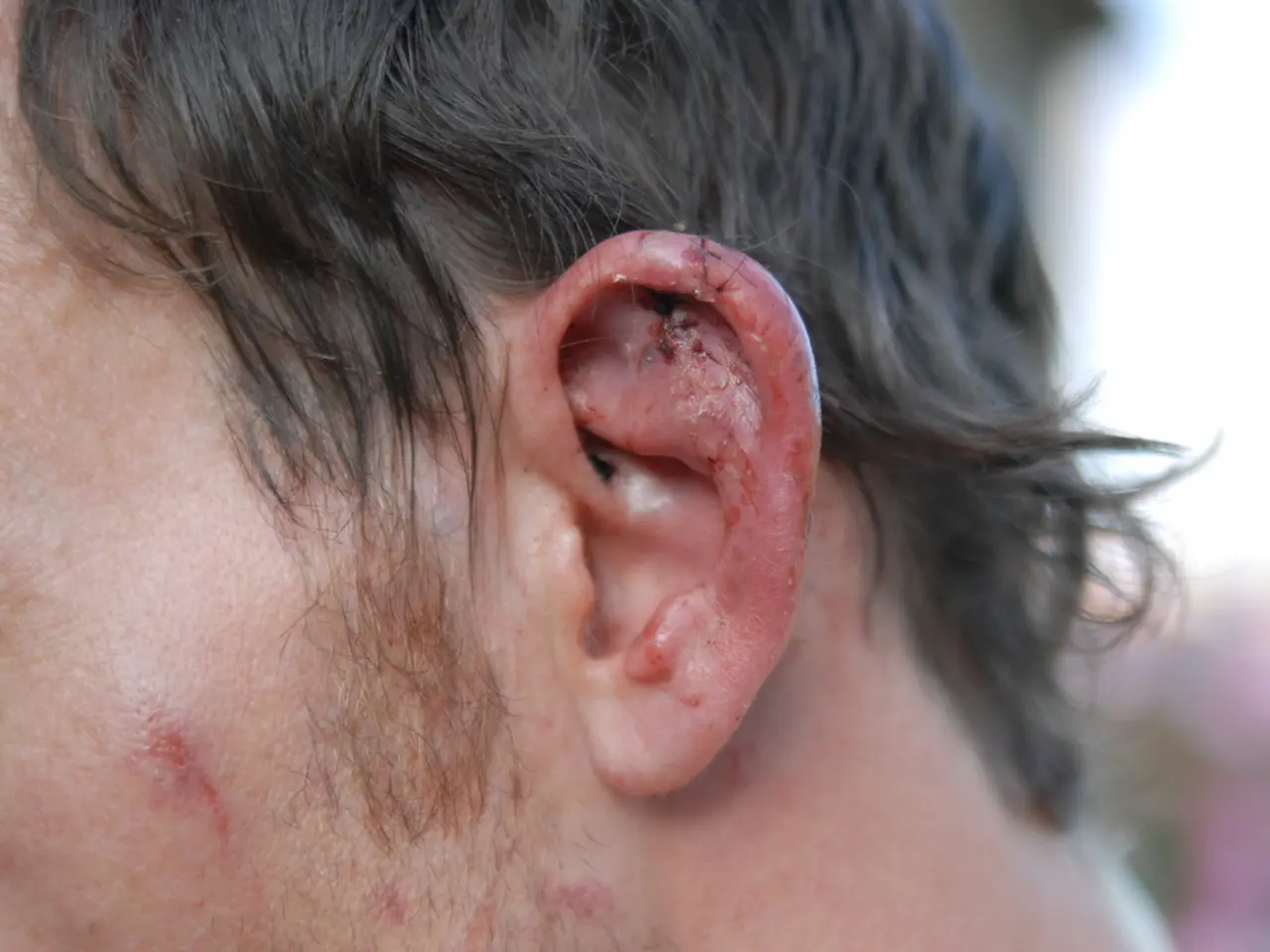 Drainage from the ear: Classifications, causes, and remedies