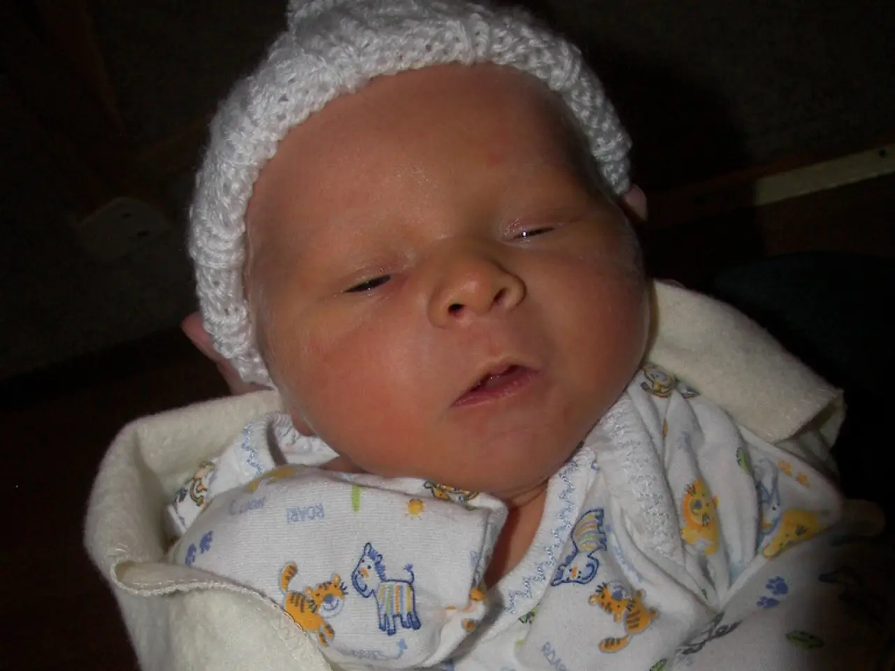 Alterations and genetics in baby skin tones