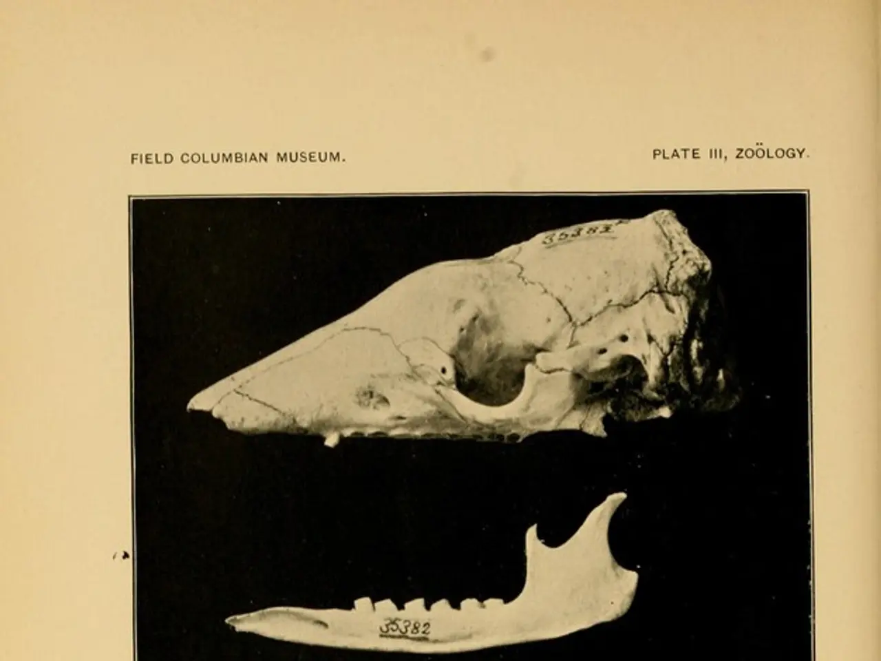 Aggressive bone growth tumor known as malignant fibrous histiocytoma