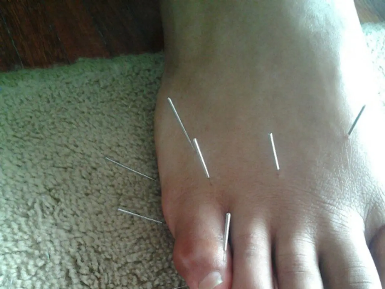 In this image I can see the person´s leg and I can see few needles and I can see the mat in cream...