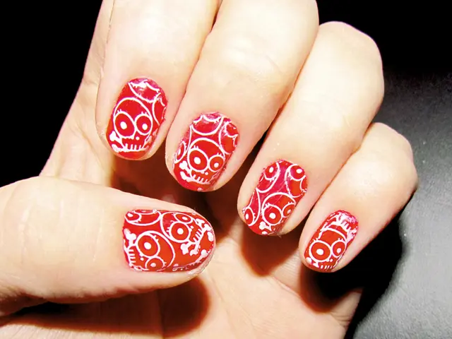 Straightforward strategies for treating an embedded fingernail: