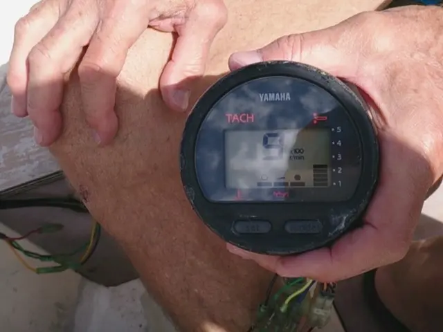 EMG Test Explained: Purpose, Preparation, Procedure, and Outcomes