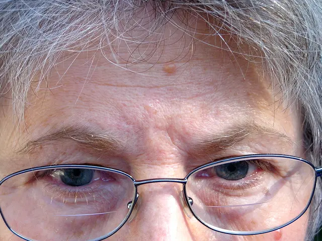 Information on Overnight Glasses: Its Benefits