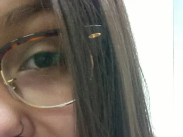 Eye Laser Surgery: Advantages, Drawbacks, and Preparatory Information