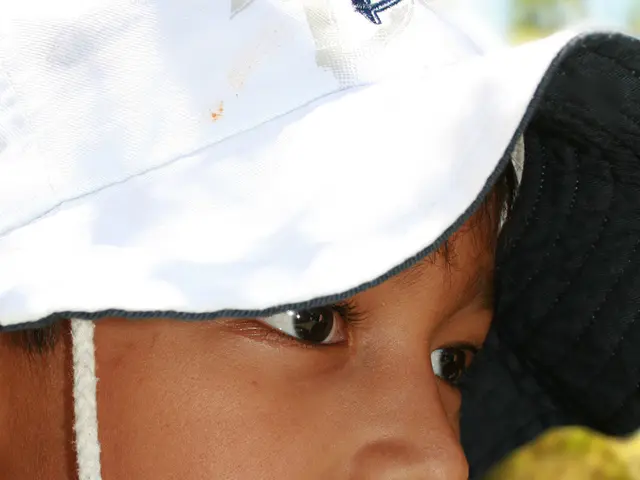 Understanding Noonan Syndrome: An Overview