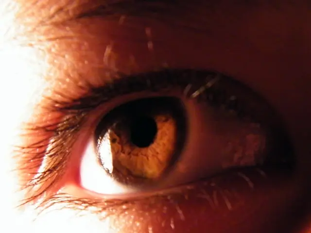 The relationship between dermatochalasis and dry eye syndrome