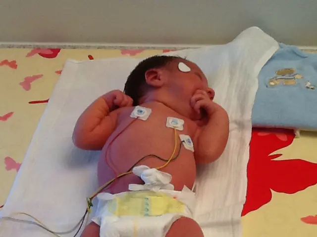 Infant Anencephaly: Understanding Causes, Diagnosis, and Management Strategies