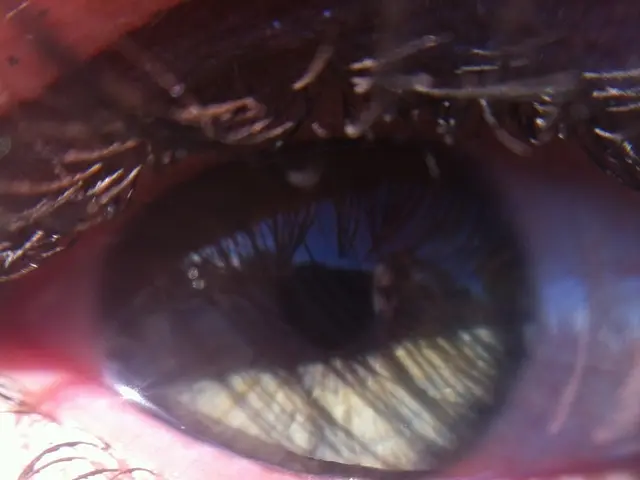 Images, signs, remedies, and additional information on eyebrow lice infestations