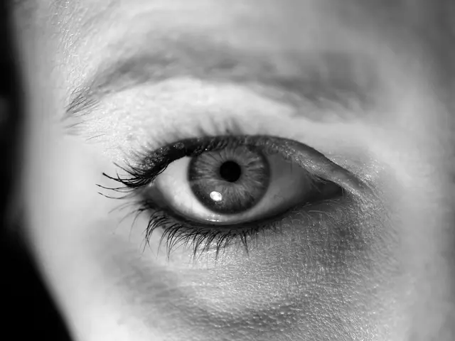 Versatile Techniques for Eliminating Eye Wrinkles, Embracing Perennial Attractiveness