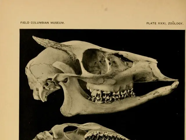 Fahr's Disorder Explanation: A Deep Dive into the Condition